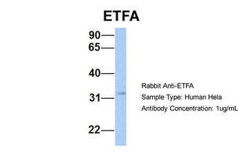 ETFA Rabbit Polyclonal Antibody