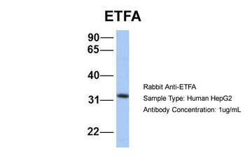 ETFA Rabbit Polyclonal Antibody