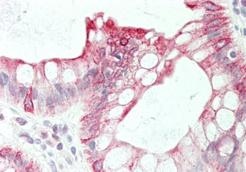 ETFA Rabbit Polyclonal Antibody