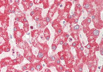 ETFA Rabbit Polyclonal Antibody