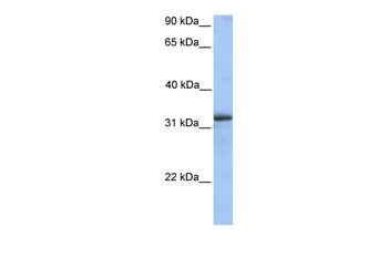 ETFA Rabbit Polyclonal Antibody