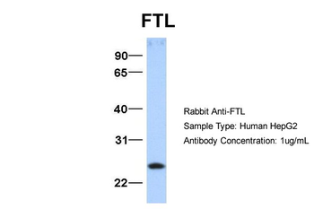 FTL Rabbit Polyclonal Antibody