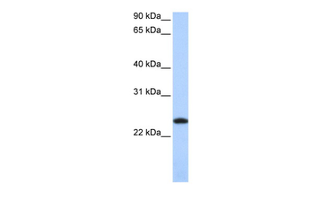 FTL Rabbit Polyclonal Antibody