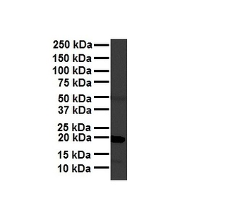 FTL Rabbit Polyclonal Antibody
