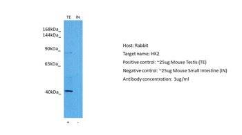 HK2 Rabbit Polyclonal Antibody