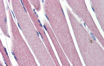 HK2 Rabbit Polyclonal Antibody