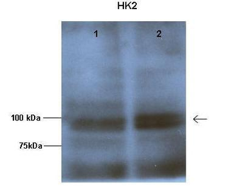 HK2 Rabbit Polyclonal Antibody