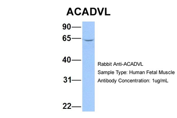 ACADVL Rabbit Polyclonal Antibody