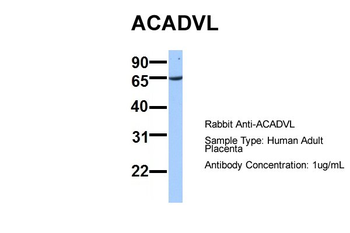 ACADVL Rabbit Polyclonal Antibody