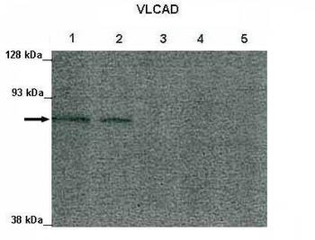 ACADVL Rabbit Polyclonal Antibody