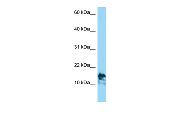 LAMA4 Rabbit Polyclonal Antibody