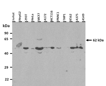 GRN Rabbit Polyclonal Antibody