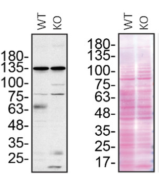 GRN Rabbit Polyclonal Antibody