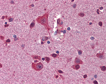 GSK3B Rabbit Polyclonal Antibody