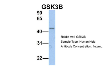 GSK3B Rabbit Polyclonal Antibody