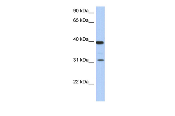 RPSA Rabbit Polyclonal Antibody