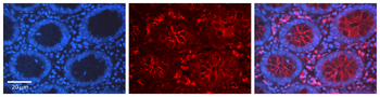 LYN Rabbit Polyclonal Antibody