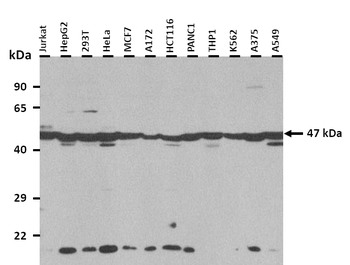 IDH1 Rabbit Polyclonal Antibody