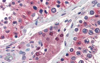 IDH1 Rabbit Polyclonal Antibody