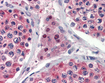 IDH1 Rabbit Polyclonal Antibody