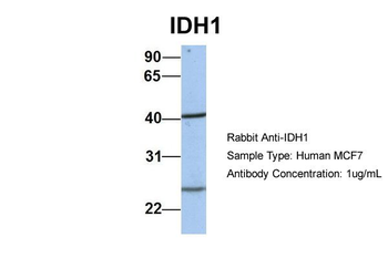 IDH1 Rabbit Polyclonal Antibody