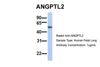 ANGPTL2 Rabbit Polyclonal Antibody