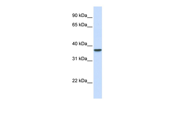 DDAH1 Rabbit Polyclonal Antibody