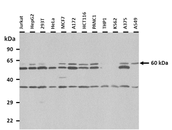 KPNA6 Rabbit Polyclonal Antibody