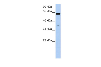 KPNA6 Rabbit Polyclonal Antibody