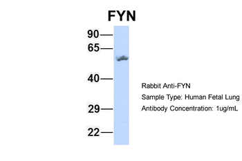 FYN Rabbit Polyclonal Antibody