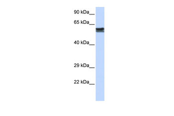 FYN Rabbit Polyclonal Antibody