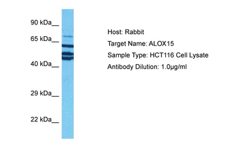 ALOX15 Rabbit Polyclonal Antibody