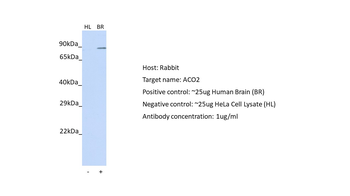 ACO2 Rabbit Polyclonal Antibody