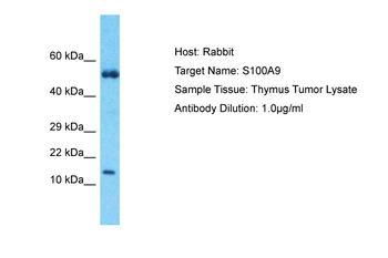 S100A9 Rabbit Polyclonal Antibody