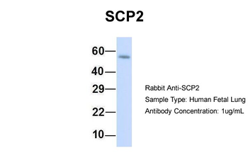 SCP2 Rabbit Polyclonal Antibody