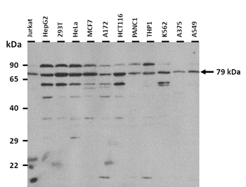 NDUFS1 Rabbit Polyclonal Antibody