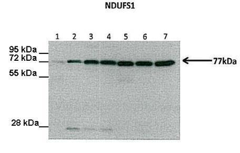 NDUFS1 Rabbit Polyclonal Antibody
