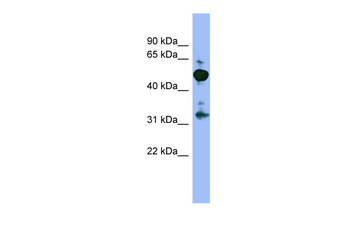 MPP2 Rabbit Polyclonal Antibody