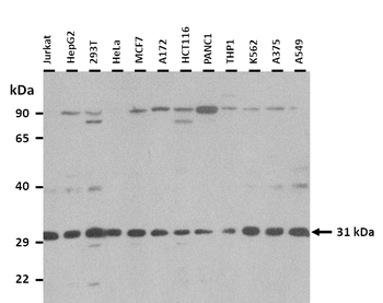 PENK Rabbit Polyclonal Antibody