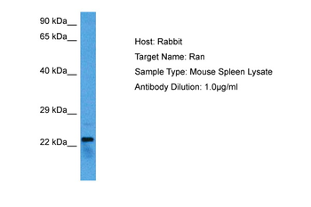 RAN Rabbit Polyclonal Antibody