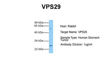 VPS29 Rabbit Polyclonal Antibody