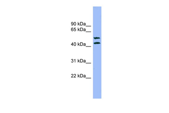 TMPRSS3 Rabbit Polyclonal Antibody