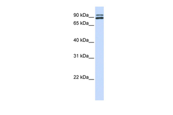 PCSK6 Rabbit Polyclonal Antibody