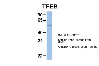 TFEB Rabbit Polyclonal Antibody