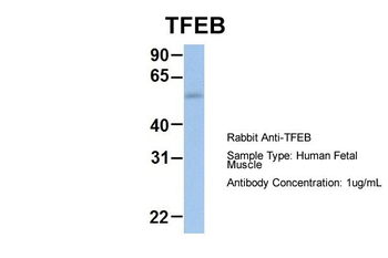 TFEB Rabbit Polyclonal Antibody