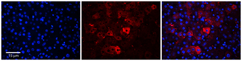 EEA1 Rabbit Polyclonal Antibody