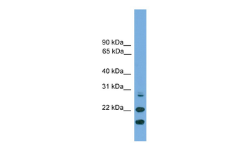 ASF1A Rabbit Polyclonal Antibody