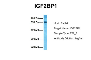 IGF2BP1 Rabbit Polyclonal Antibody