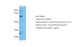 IGF2BP1 Rabbit Polyclonal Antibody