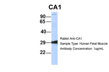 CA1 Rabbit Polyclonal Antibody